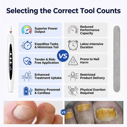 SOVS Professional Electric Nail Drill Pen | Nail Care Tool for Preparing Thickened Nails Before Treatment