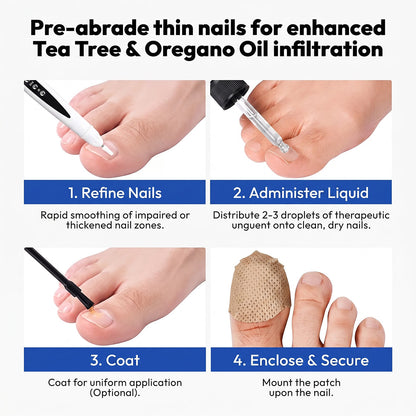 SOVS Professional Electric Nail Drill Pen | Nail Care Tool for Preparing Thickened Nails Before Treatment